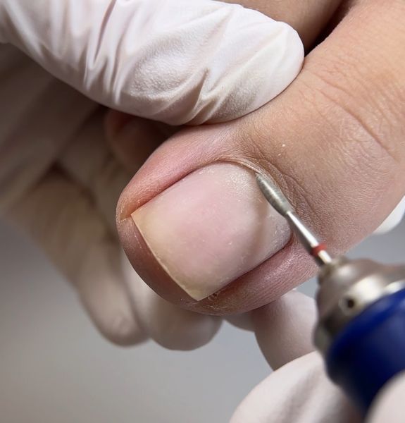 macrO diamond cutters 20pcs, "sharp flame", red notch, d 023