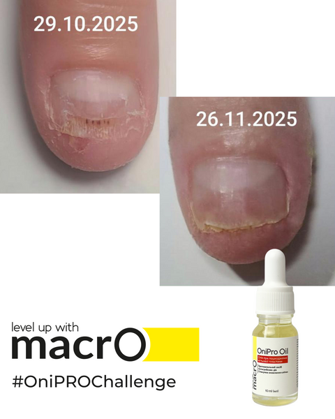 Набір олійок від оніхолізісу macrO OniPro Oil, 10 шт. ONIPRO-10-10 фото