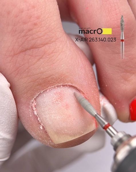 Фреза алмазна macrO X-AIR, "полум'я безпечне", червона насічка, d 023  X-AIR 263.140.023 фото